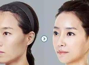 上海健丽医疗美容门诊部探访 正规资质、特色项目与地址详情一览